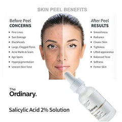 The Ordinary- Niacinamide 10% + Zinc 1% 30Ml